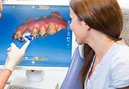 Dental patient looking at CEREC design