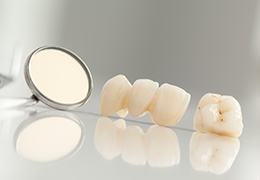 Dental crown and bridge restorations before placement