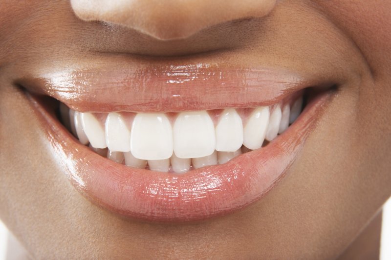 woman in Greater Inwood shows off whitened teeth